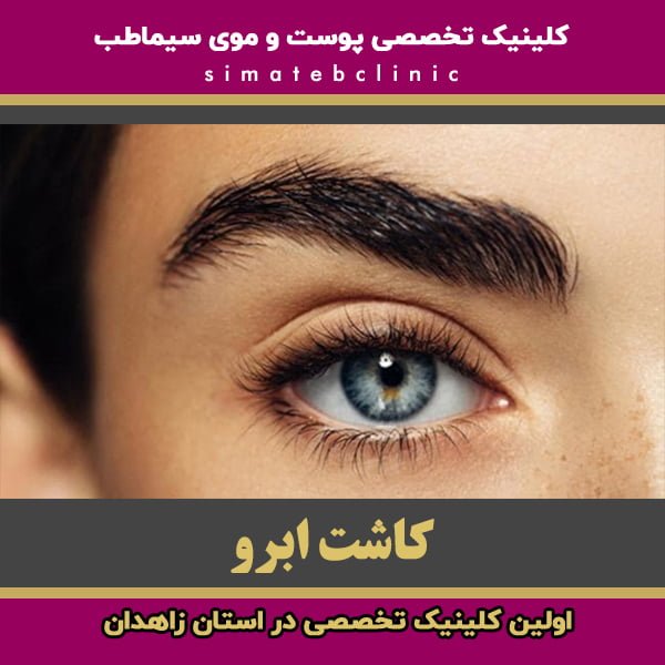 کاشت ابرو در زاهدان