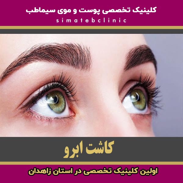 کاشت ابرو در زاهدان