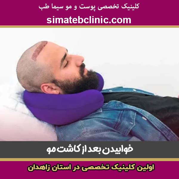 خوابیدن بعد از کاشت مو - کلینیک پوست و مو سیماطب زاهدان