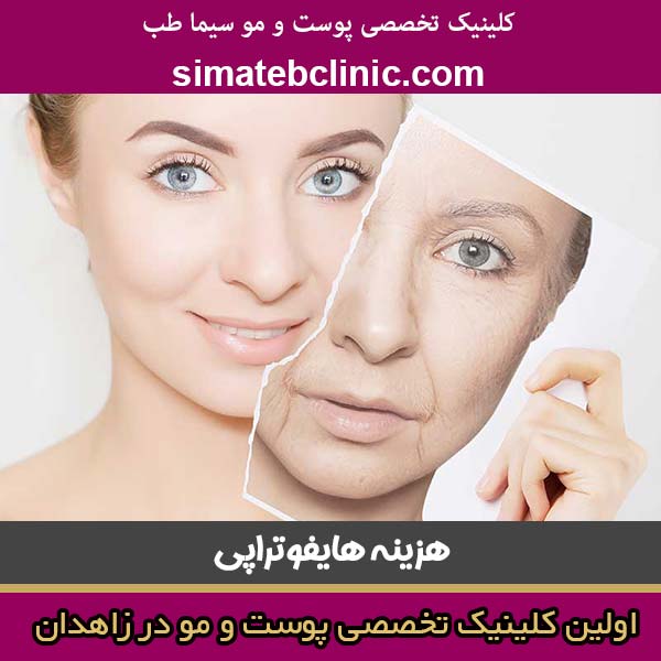 هزینه هایفوتراپی