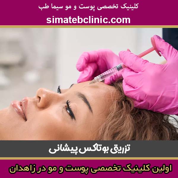 تزریق بوتاکس پیشانی