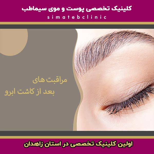 مراقبت های بعد از کاشت ابرو