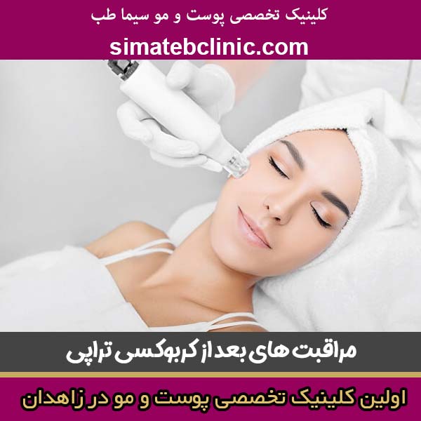مراقبت های بعد از کربوکسی تراپی صورت