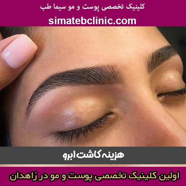هزینه کاشت ابرو